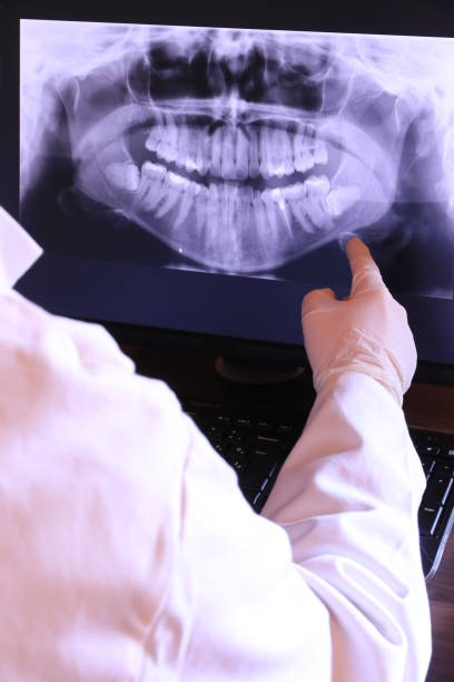 Best Emergency Dental Care for Sports Injuries in Howard City, MI