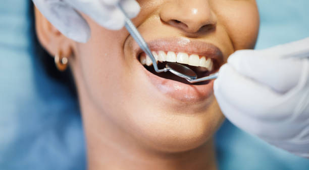 Best Knocked-Out Tooth (Avulsed Tooth) Treatment in Howard City, MI